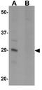 Signaling lymphocytic activation molecule antibody, GTX31432, GeneTex, Western Blot image 
