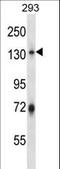 E3 ubiquitin-protein ligase BRE1A antibody, LS-C162655, Lifespan Biosciences, Western Blot image 