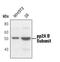 Protein Phosphatase 2 Regulatory Subunit Balpha antibody, PA5-17515, Invitrogen Antibodies, Western Blot image 