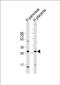 Protein Phosphatase 1 Regulatory Subunit 3E antibody, PA5-72336, Invitrogen Antibodies, Western Blot image 