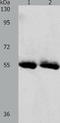 Sodium-iodide symporter antibody, TA321131, Origene, Western Blot image 