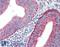 HAVcr-1 antibody, LS-B2463, Lifespan Biosciences, Immunohistochemistry frozen image 