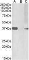 Myogenic Factor 6 antibody, PA5-19291, Invitrogen Antibodies, Western Blot image 