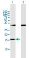 POP7 Homolog, Ribonuclease P/MRP Subunit antibody, H00010248-B01P, Novus Biologicals, Western Blot image 