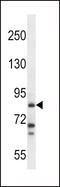 Histidine Decarboxylase antibody, LS-C166825, Lifespan Biosciences, Western Blot image 