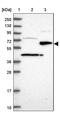 Suppressor of tumorigenicity 7 protein antibody, PA5-58344, Invitrogen Antibodies, Western Blot image 