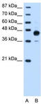 Homeobox C10 antibody, TA345213, Origene, Western Blot image 