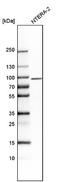 Stonin-1 antibody, NBP1-80795, Novus Biologicals, Western Blot image 