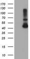 Alcohol Dehydrogenase 7 (Class IV), Mu Or Sigma Polypeptide antibody, LS-C173997, Lifespan Biosciences, Western Blot image 