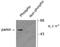 Parkin RBR E3 Ubiquitin Protein Ligase antibody, TA309210, Origene, Western Blot image 