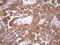 Charged Multivesicular Body Protein 5 antibody, LS-C799007, Lifespan Biosciences, Immunohistochemistry paraffin image 