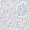 Filaggrin antibody, HPA030189, Atlas Antibodies, Immunohistochemistry paraffin image 