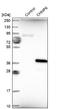 Charged Multivesicular Body Protein 6 antibody, NBP1-83727, Novus Biologicals, Western Blot image 