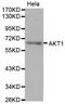 Protein kinase B antibody, TA332743, Origene, Western Blot image 