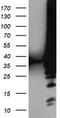 Low Density Lipoprotein Receptor Adaptor Protein 1 antibody, TA503856S, Origene, Western Blot image 