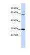 CD40 Ligand antibody, NBP1-59186, Novus Biologicals, Western Blot image 
