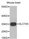 Solute Carrier Family 7 Member 5 antibody, PA5-76141, Invitrogen Antibodies, Western Blot image 