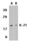 Interleukin-21 antibody, AHP1615, Bio-Rad (formerly AbD Serotec) , Immunohistochemistry frozen image 