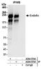 Zinc Finger FYVE-Type Containing 16 antibody, A304-574A, Bethyl Labs, Immunoprecipitation image 
