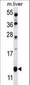 Golgi Transport 1B antibody, LS-C166585, Lifespan Biosciences, Western Blot image 
