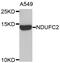 NADH:Ubiquinone Oxidoreductase Subunit C2 antibody, MBS128662, MyBioSource, Western Blot image 
