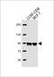 Aftiphilin antibody, 62-045, ProSci, Western Blot image 