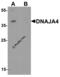 DnaJ Heat Shock Protein Family (Hsp40) Member A4 antibody, 8141, ProSci Inc, Western Blot image 