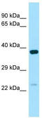 Nucleoredoxin Like 1 antibody, TA337913, Origene, Western Blot image 