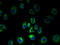 Cationic amino acid transporter 3 antibody, A67070-100, Epigentek, Immunofluorescence image 