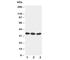 Dickkopf WNT Signaling Pathway Inhibitor 1 antibody, R30534, NSJ Bioreagents, Western Blot image 