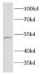 EGF Containing Fibulin Extracellular Matrix Protein 2 antibody, FNab02657, FineTest, Western Blot image 