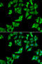 Aspartylglucosaminidase antibody, abx004855, Abbexa, Western Blot image 