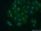 Vesicle Associated Membrane Protein 4 antibody, 10738-1-AP, Proteintech Group, Immunofluorescence image 