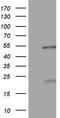 Nuclear Receptor Subfamily 5 Group A Member 1 antibody, LS-C339851, Lifespan Biosciences, Western Blot image 