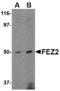 Fasciculation and elongation protein zeta-2 antibody, A10063, Boster Biological Technology, Western Blot image 