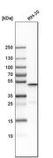 Acyl-CoA Thioesterase 9 antibody, HPA035533, Atlas Antibodies, Western Blot image 