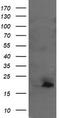 Ubiquitin-conjugating enzyme E2 G2 antibody, TA505259AM, Origene, Western Blot image 
