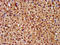 Patatin Like Phospholipase Domain Containing 8 antibody, LS-C673020, Lifespan Biosciences, Immunohistochemistry paraffin image 