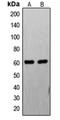 Fas-activated serine/threonine kinase antibody, LS-C353295, Lifespan Biosciences, Western Blot image 