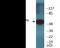 HMG-Box Transcription Factor 1 antibody, EKC2289, Boster Biological Technology, Western Blot image 