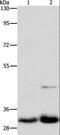 DNA-3-methyladenine glycosylase antibody, LS-C401428, Lifespan Biosciences, Western Blot image 