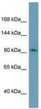 Cap Methyltransferase 1 antibody, TA333851, Origene, Western Blot image 