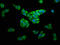 DLTS antibody, LS-C670016, Lifespan Biosciences, Immunofluorescence image 