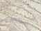 Trafficking Protein Particle Complex 3 antibody, A61474-100, Epigentek, Immunohistochemistry paraffin image 
