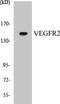 Kinase Insert Domain Receptor antibody, EKC1594, Boster Biological Technology, Western Blot image 