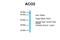 Aconitase antibody, ARP56302_P050, Aviva Systems Biology, Western Blot image 