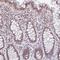 Nucleolar Protein 6 antibody, PA5-63202, Invitrogen Antibodies, Immunohistochemistry frozen image 