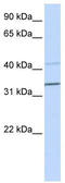Pyrin And HIN Domain Family Member 1 antibody, TA339836, Origene, Western Blot image 