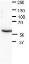 Chromatin Assembly Factor 1 Subunit B antibody, TA338925, Origene, Western Blot image 
