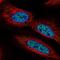 Protein CBFA2T2 antibody, HPA072433, Atlas Antibodies, Immunofluorescence image 